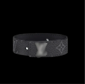 V Bracelet